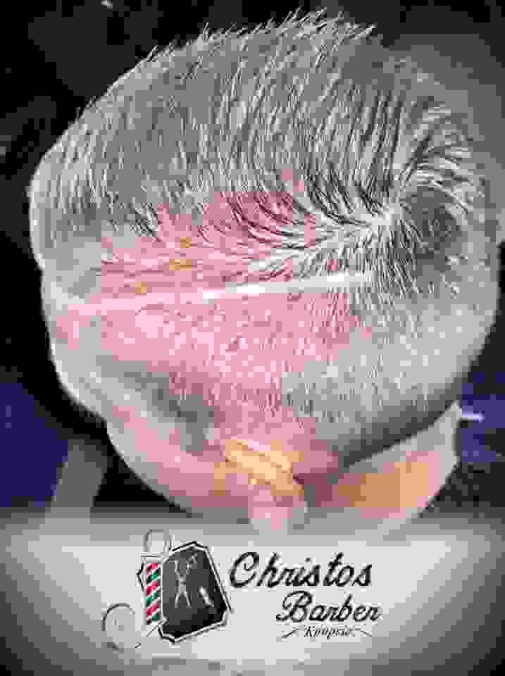 ch18