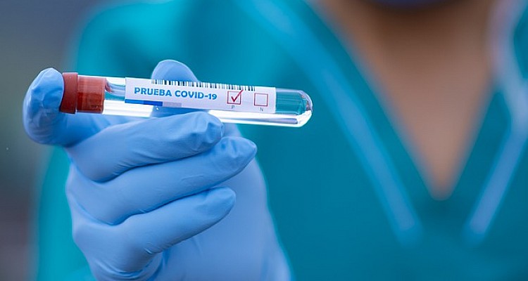 Κορονοϊός: Νέο σοκ με 3.227 νέα κρούσματα και 59 νεκρούς – 499 διασωληνωμένοι