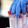 1 Κρούσμα στην Κεφαλονια από ιδιωτικό εργαστήριο Κορονοϊός κρούσματα σήμερα 01-12-2020 στην Ελλάδα