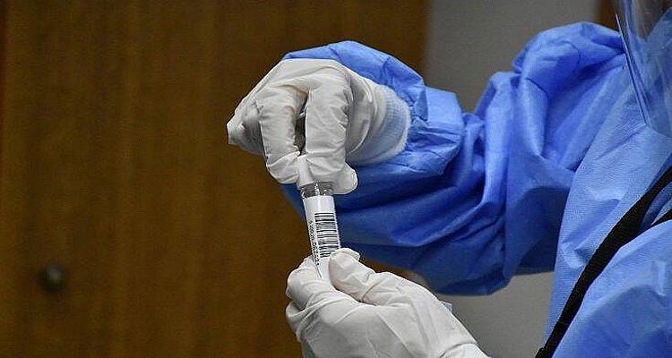 Κορονοϊός: Testing.gov.gr – Τι είναι και πώς θα λειτουργεί η νέα πλατφόρμα τυχαιοποιημένου ελέγχου