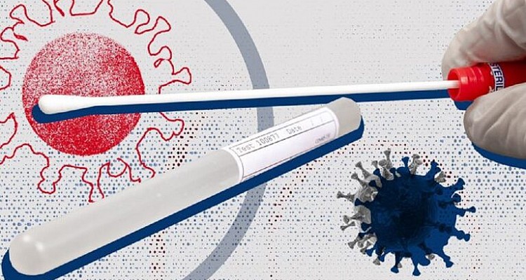 Κορονοϊός: 236 κρούσματα, 18 θάνατοι, 231 διασωληνωμένοι – Η κατανομή