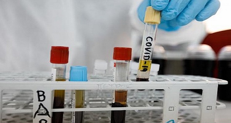 Μειώθηκαν στους 392 οι διασωληνωμένοι – 808 νέα κρούσματα και 24 νεκροί – Η γεωγραφική κατανομή