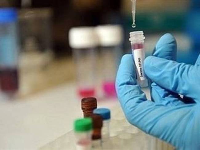 Ζητείται προσωπικό σε Μικροβιολογικό Εργαστήριο