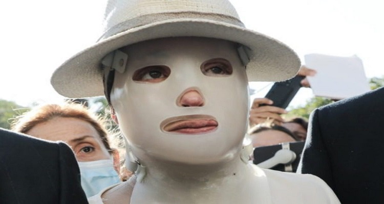 Επίθεση με βιτριόλι: Τι είναι η ειδική μάσκα που φοράει η Ιωάννα Παλιοσπύρου