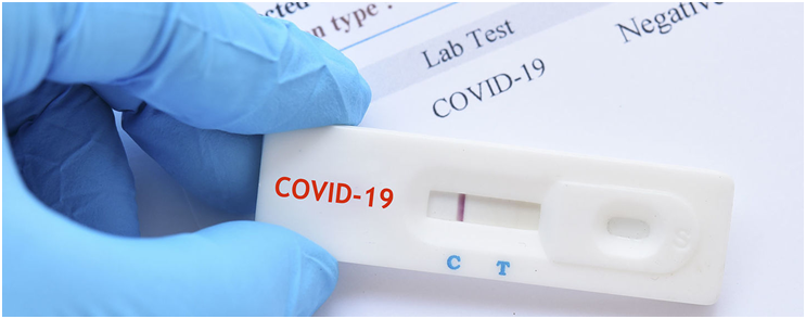 ΔΙΕΝΕΡΓΕΙΑ RAPID TESTS ΓΙΑ ΤΟΝ ΓΕΝΙΚΟ ΠΛΗΘΥΣΜΟ
