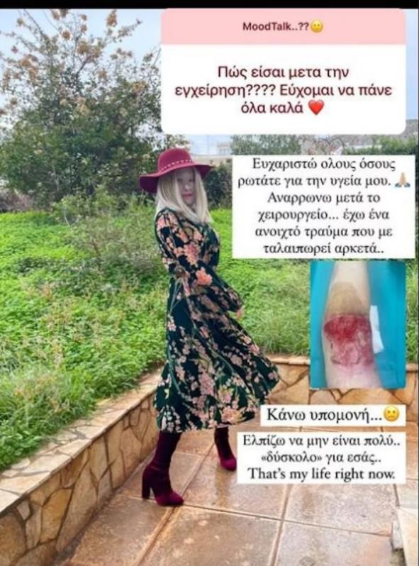 Ιωάννα Παλιοσπύρου: «Έχω ανάγκη να μοιραστώ τη νέα μου εικόνα» – Πότε θα βγάλει τη μάσκα