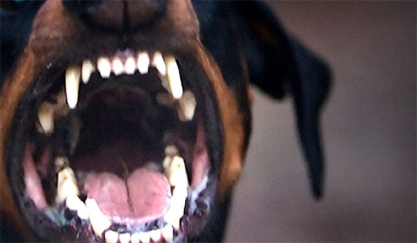 Εύβοια: Ροτβάιλερ επιτέθηκε σε 6χρονο – Μεταφέρθηκε στο Παίδων τραύματα στο κεφάλι