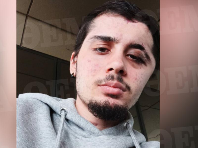 O 17χρονος που ξύπνησε από κώμα: «Προσπάθησα να μιλήσω στη μαμά μου αλλά δεν έβγαινε η φωνή μου»